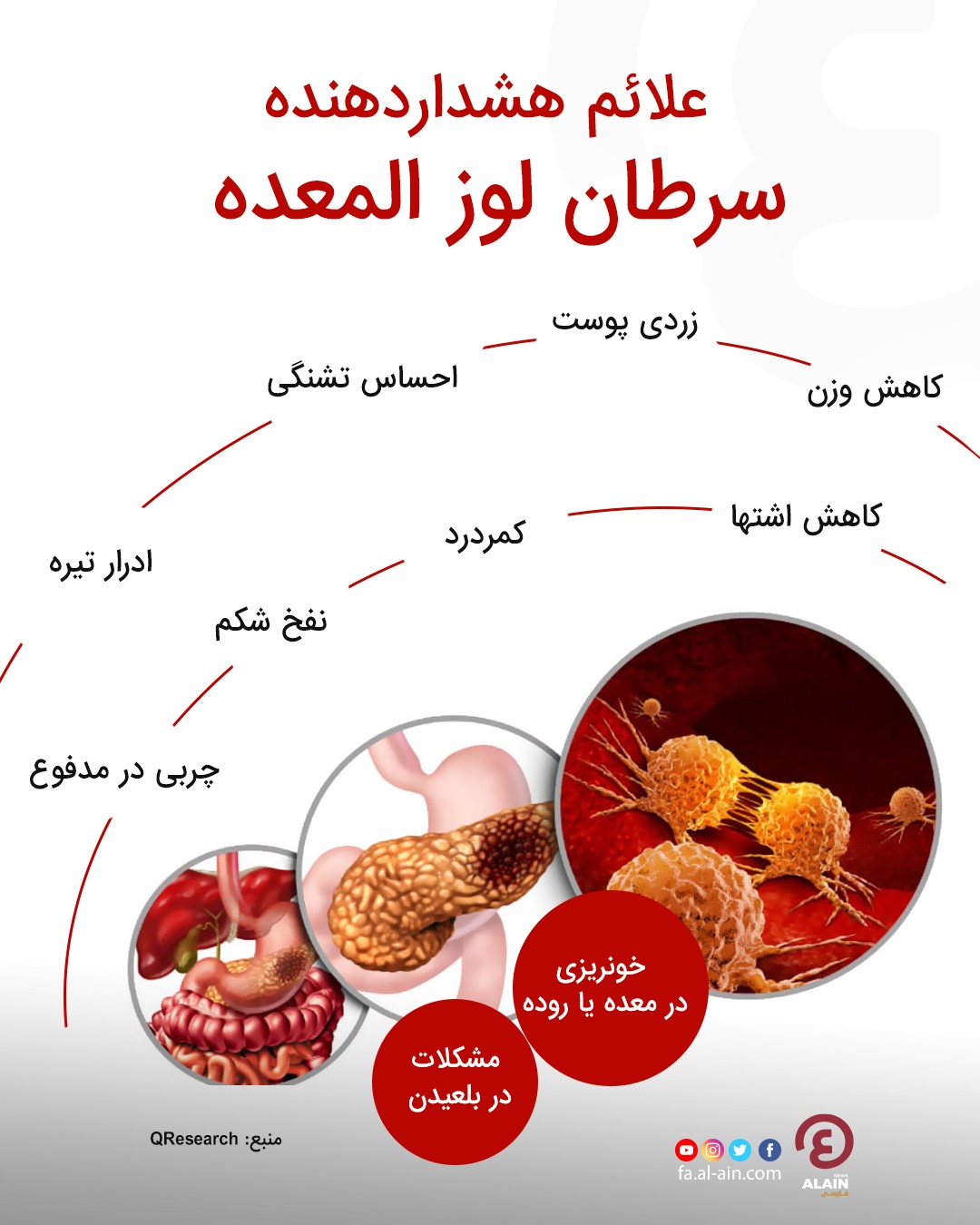 علائم سرطان لوزالمعده
