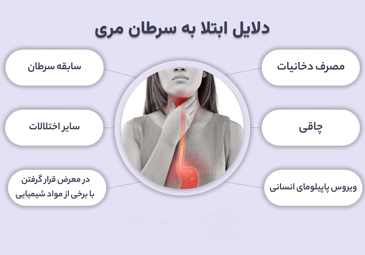 دلایل سرطان مری