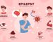 بیماری صرع چیست