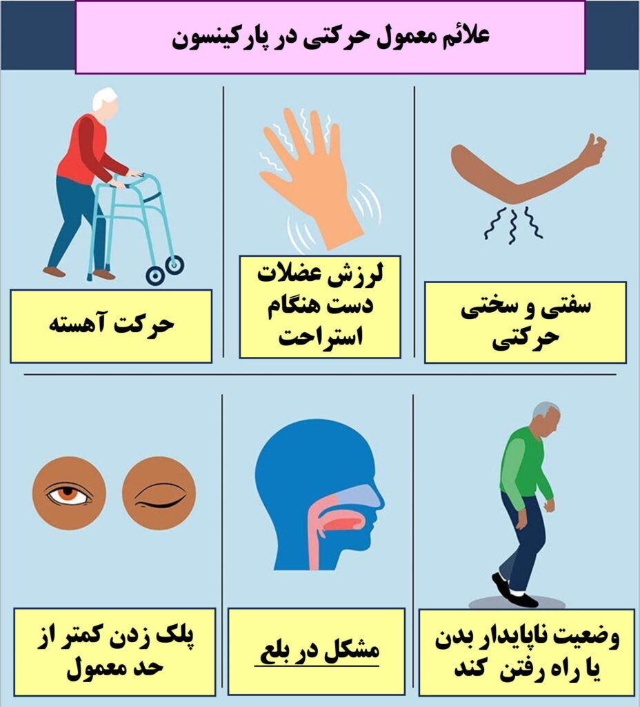 پارکینسون