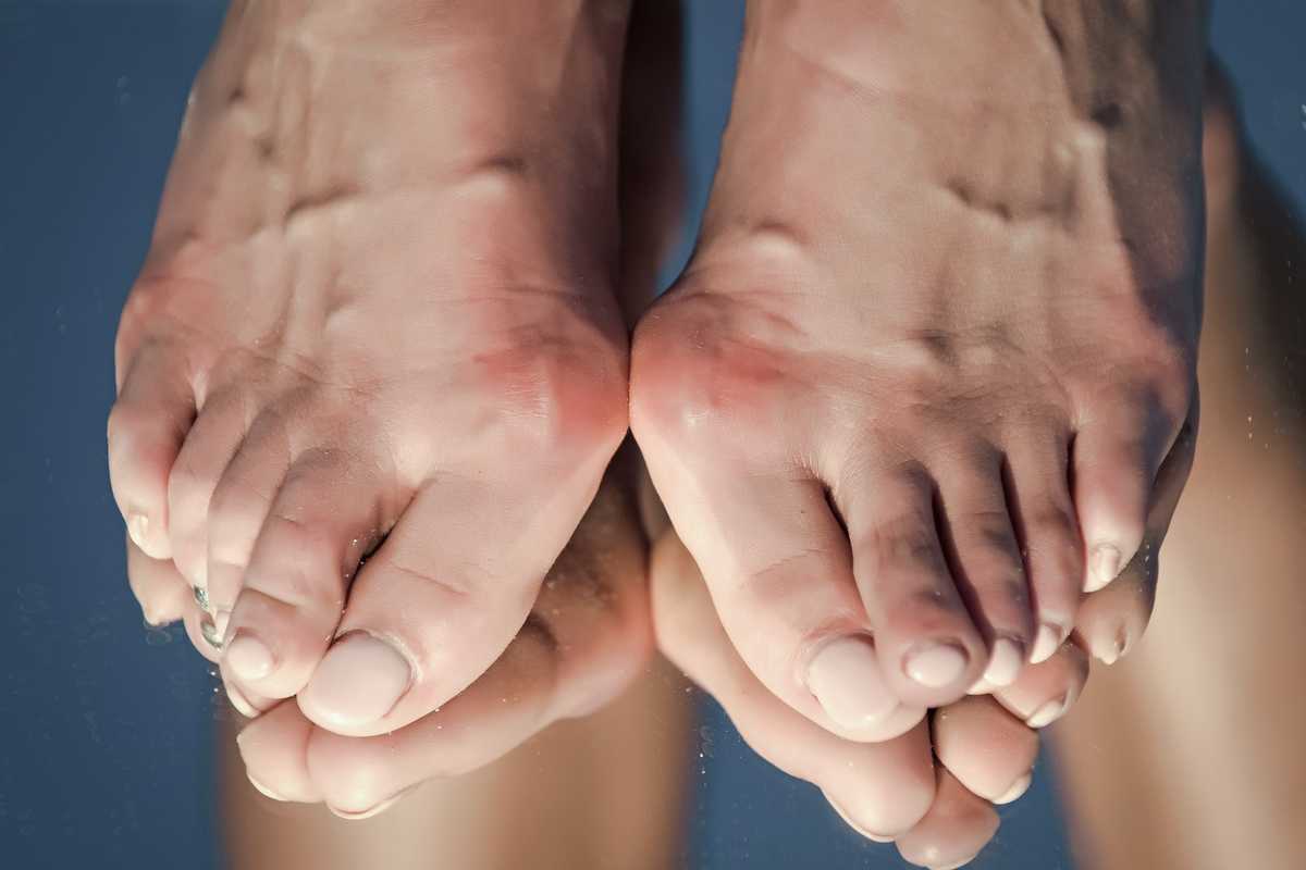 تاریخچه بیماری نقرس